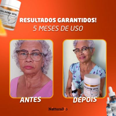 Collagen Vitta é bom